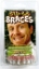 Picture of Billy Bob Braces Teeth